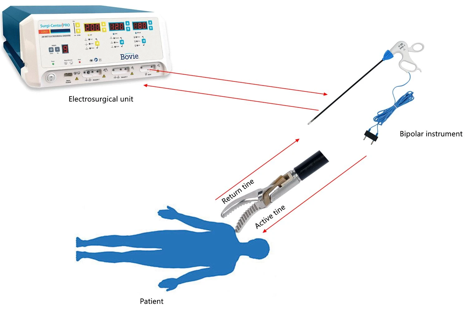 Monopolar VS. Bipolární elektrochirurgie
